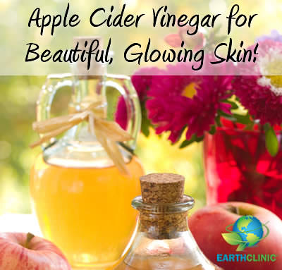 Apple Cider Vinegar for Beautiful Skin