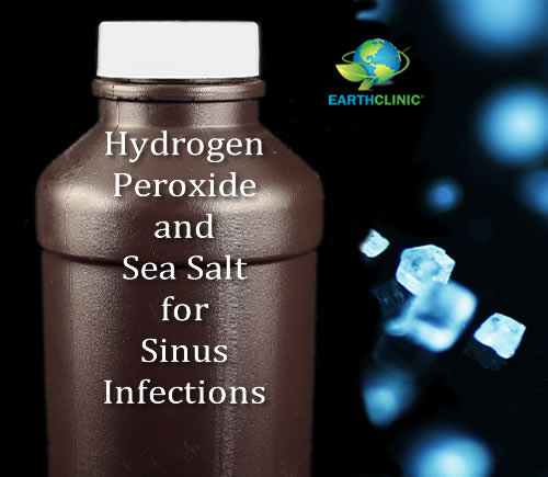 Greensations Sinus Plumber Hydrogen Peroxide Nasal Rinse Salt - 4