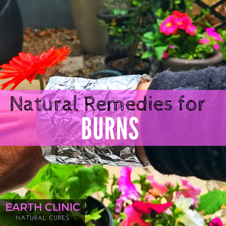 9 Home Remedies to Treat Sunburn Naturally