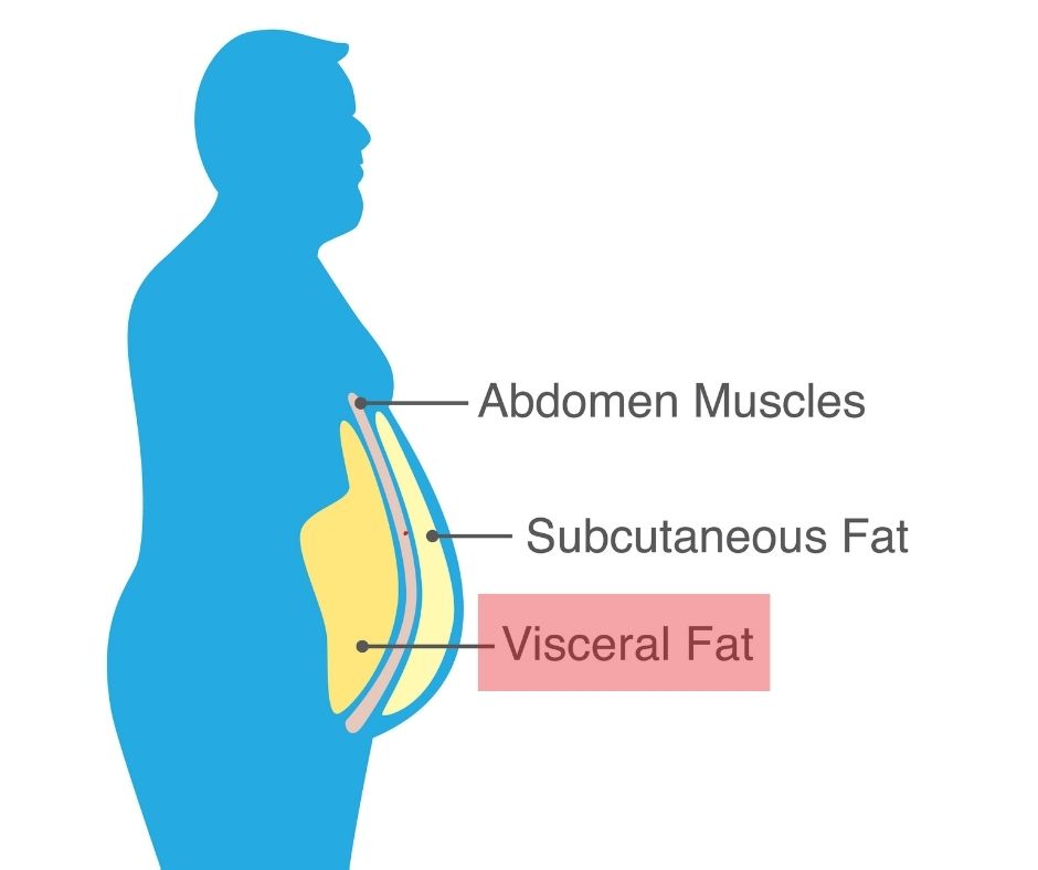 Body Fat Distribution: Subcutaneous vs. Visceral Fat, Fort Collins Back  Pain