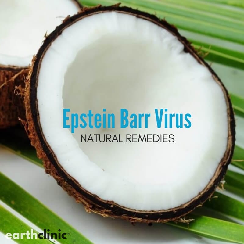 10 Natural Remedies for Epstein-Barr Virus - Earth Clinic