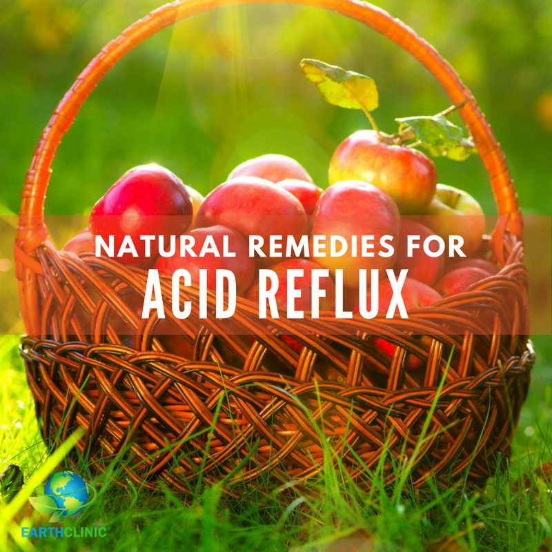 What is acid reflux remedy